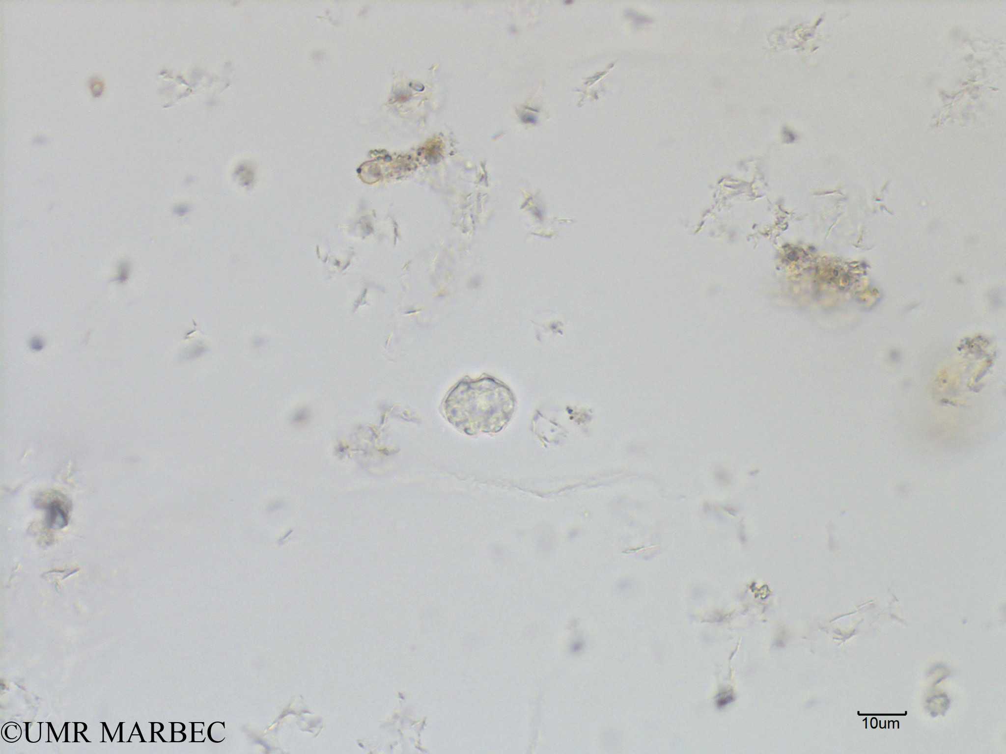 phyto/Bizerte/bizerte_bay/RISCO July 2016/Scrippsiella spp (Baie_T1A-dino cf alex-13).tif(copy).jpg